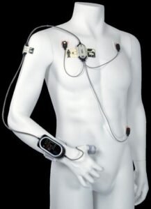Monitoring